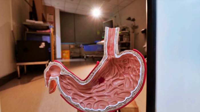 명의-위염-만성위염-장상피화생-위암-모습