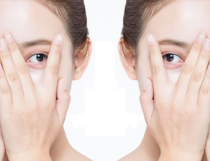 눈을 표시하는 사진