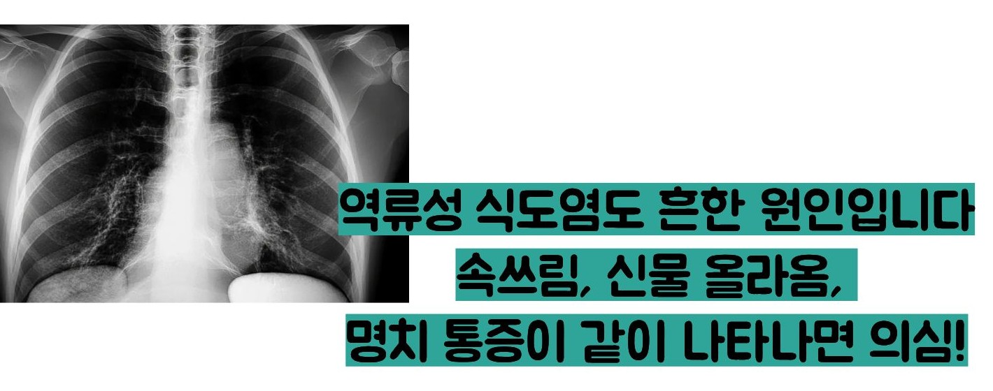 명치가 답답해요