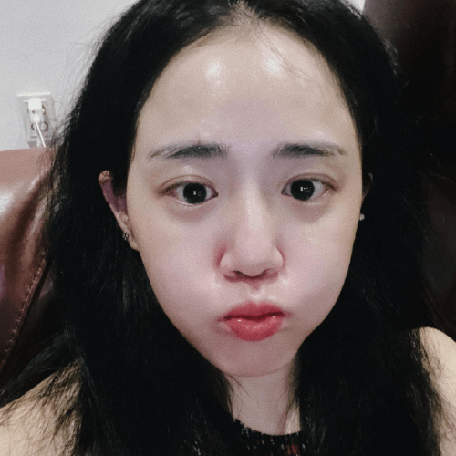 문근영 GV 불참