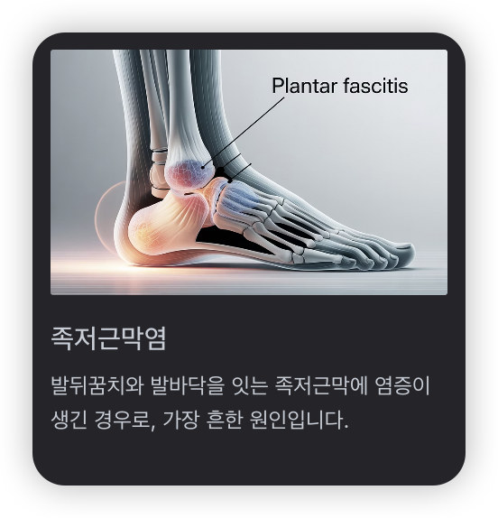 발바닥-통증-부위-족저근막염