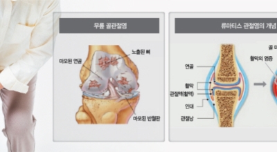 무릎 이미지