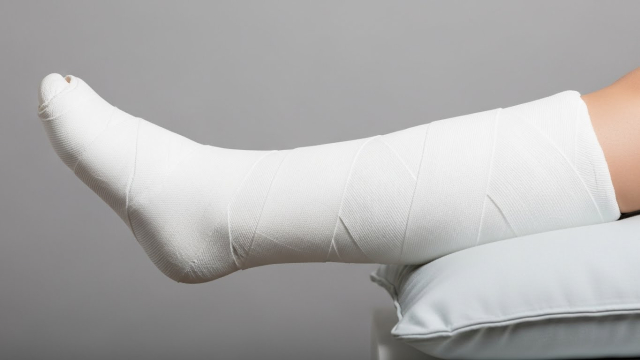 종아리부터 발까지 석고 깁스를 한 다리를 보여주는 장면