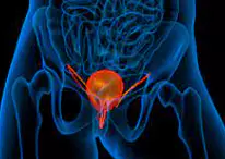 방광염-증상-건강