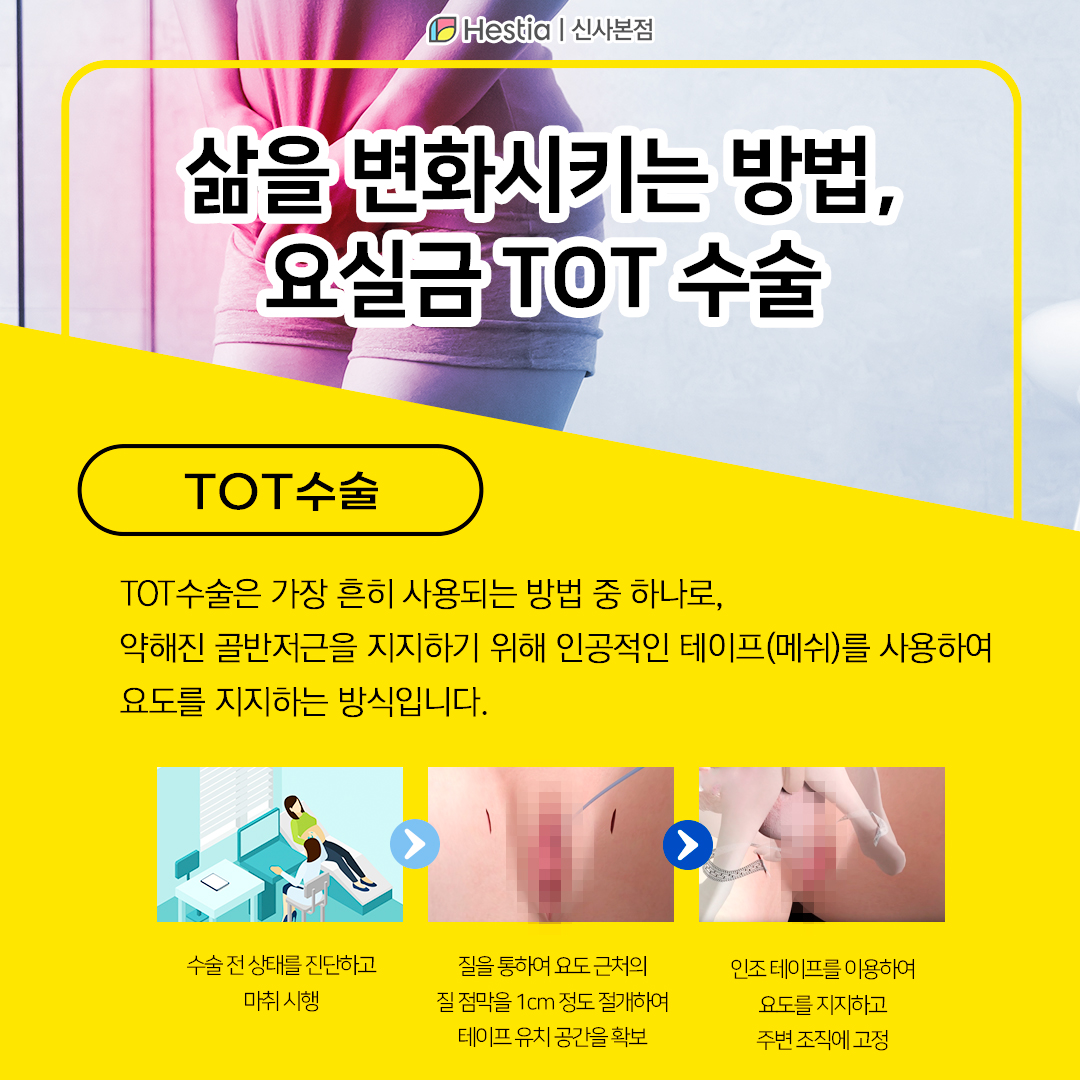 삶을 변화시키는 방법, TOT 요실금수술