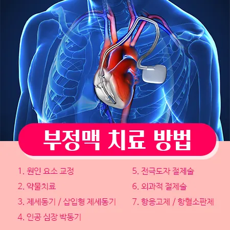 부정맥 치료
