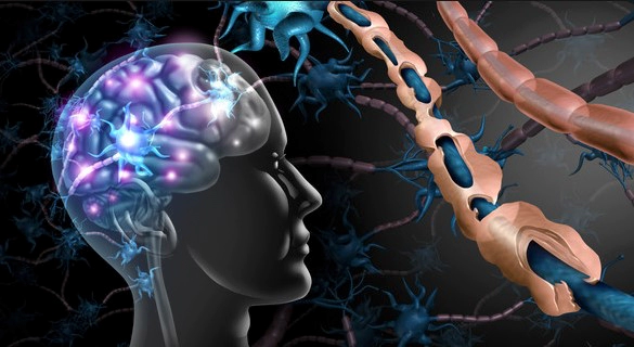 다발성 경화증 증상