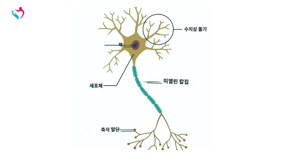 다발성 경화증(MS)이나 시신경척수염 스펙트럼 장애(NMOSD)