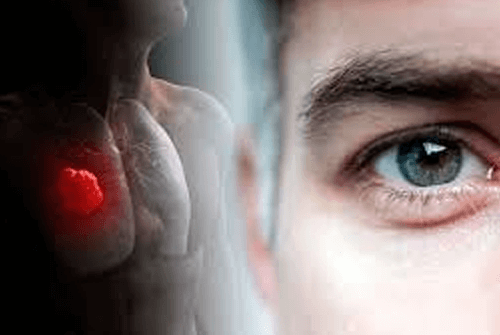 폐암초기증상09