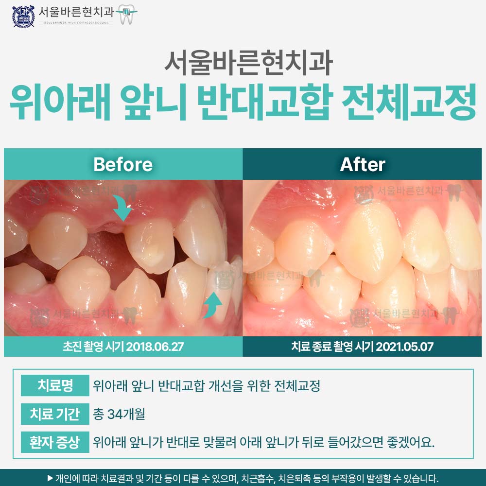 해운대교정치과