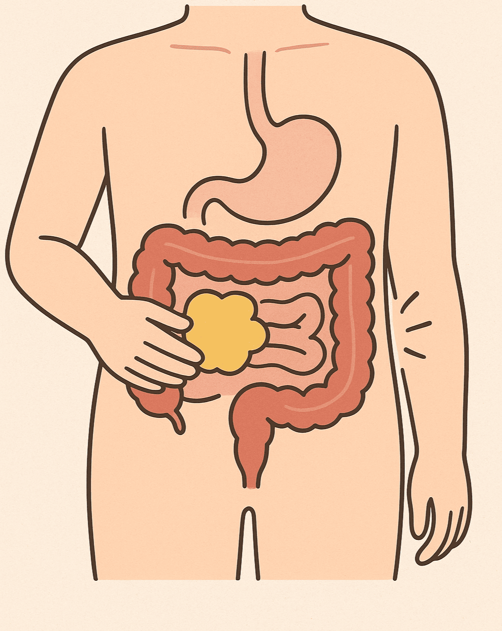 마비성 장폐색 소화기관