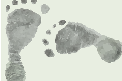 족저근막염 증상, 원인, 치료법 총 정리 (2024 최신)