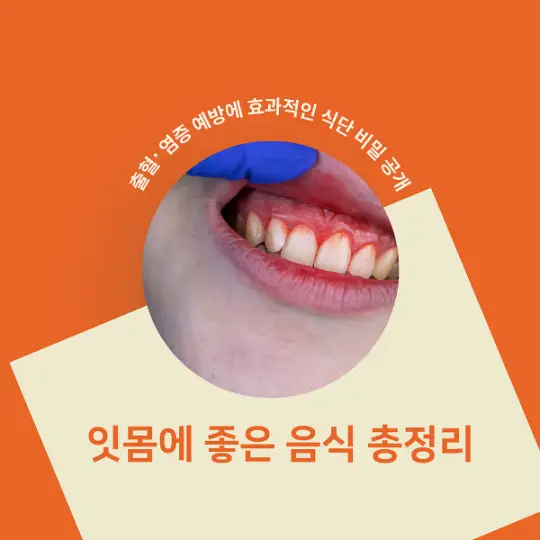 잇몸에 좋은 음식