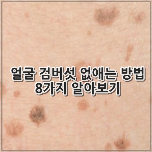 얼굴 검버섯 없애는 방법 8가지 알아보기