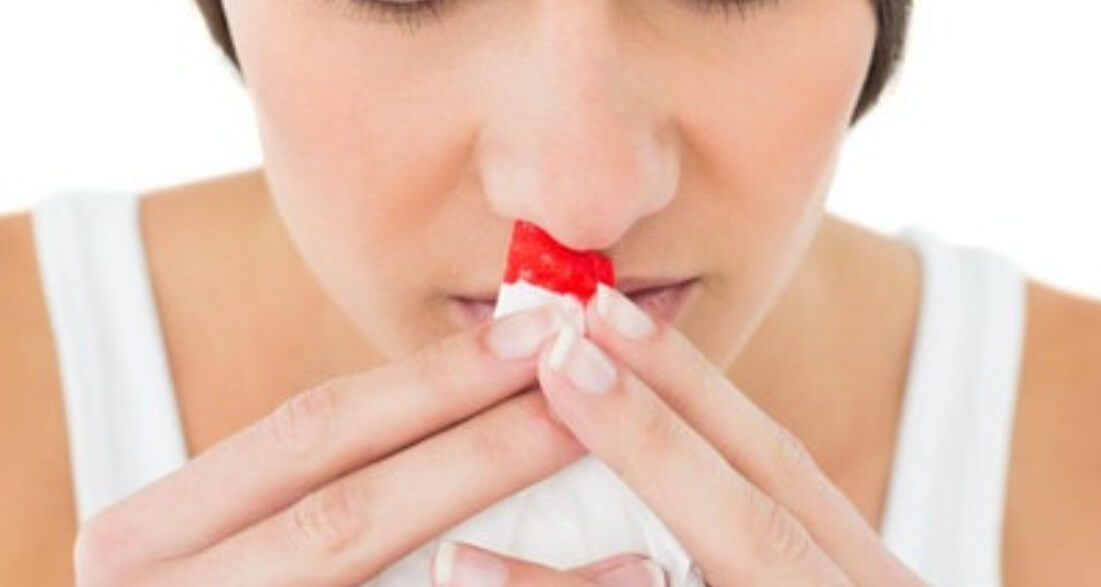 코피가 계속 나는 여성