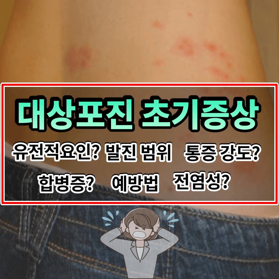 대상포진 초기증상