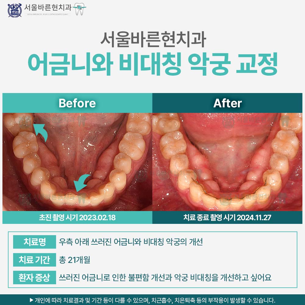 해운대교정치과