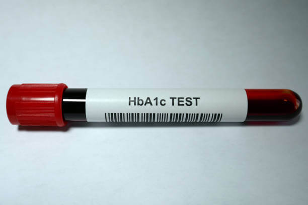 당화혈색소 낮추기&amp;#44; 검사와 정상수치