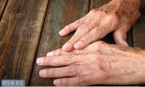 피부 노화 방지