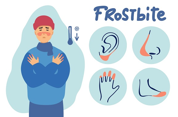 겨울 한랭질환 저체온증 동상