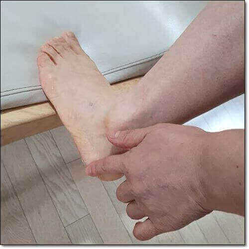 발 뒤꿈치에 바세린 바르는 여성