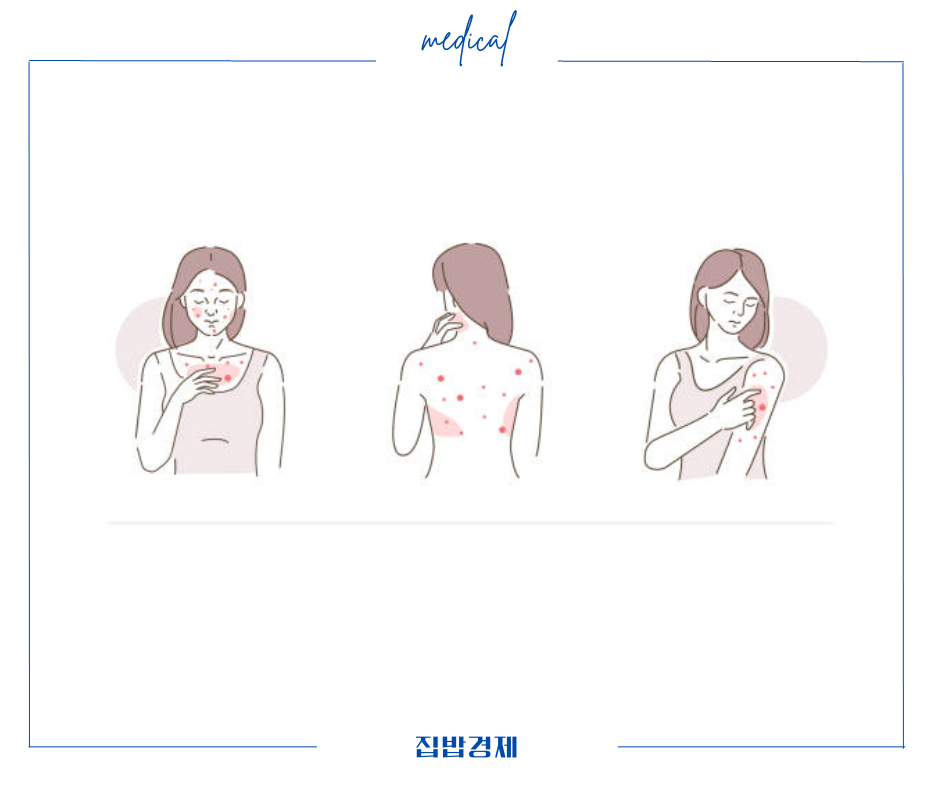 록소앤겔 부작용