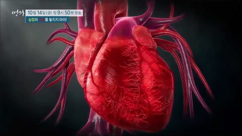 명의 심장마비 전조증상! 관상동맥질환 협심증 심근경색증, 대동맥 판막 스텐트 치료 클리닉