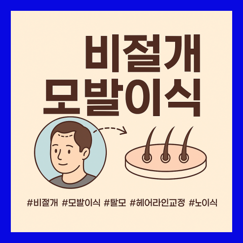 비절개 모발이식과 절개 방식 및 가격 차이 정리