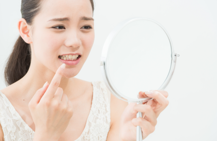 입안을 살펴보는 여성