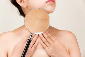 목주름-시술-비용