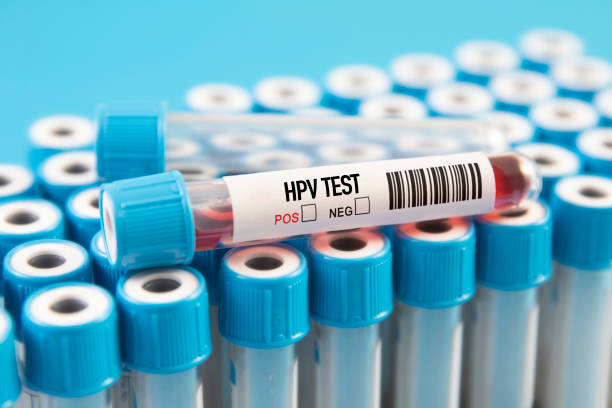 HPV바이러스 고위험군에 해당하는 유형은 몇번 16번 18번 31번,33번,35번,39번,45번,51번,52번,56번,58번,59번,68번