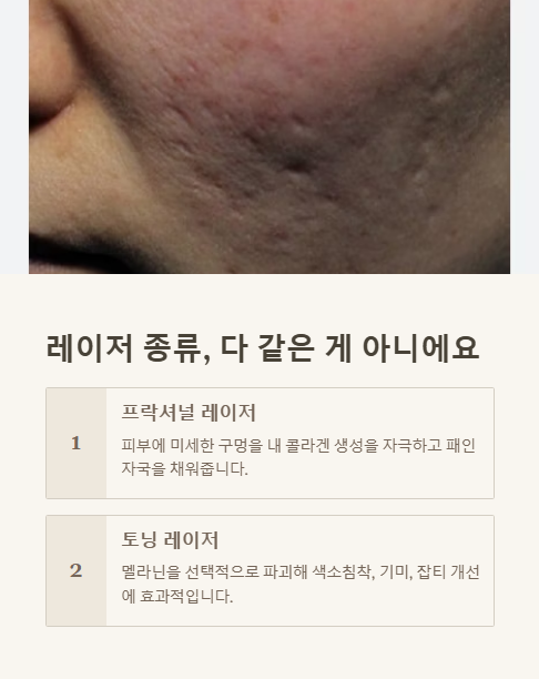 레이저 종류 다 같은 게 아니에요