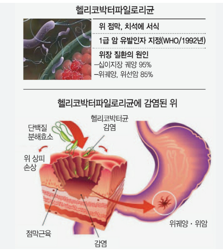 헬리코박터 감염 시 증상 관련 이미지