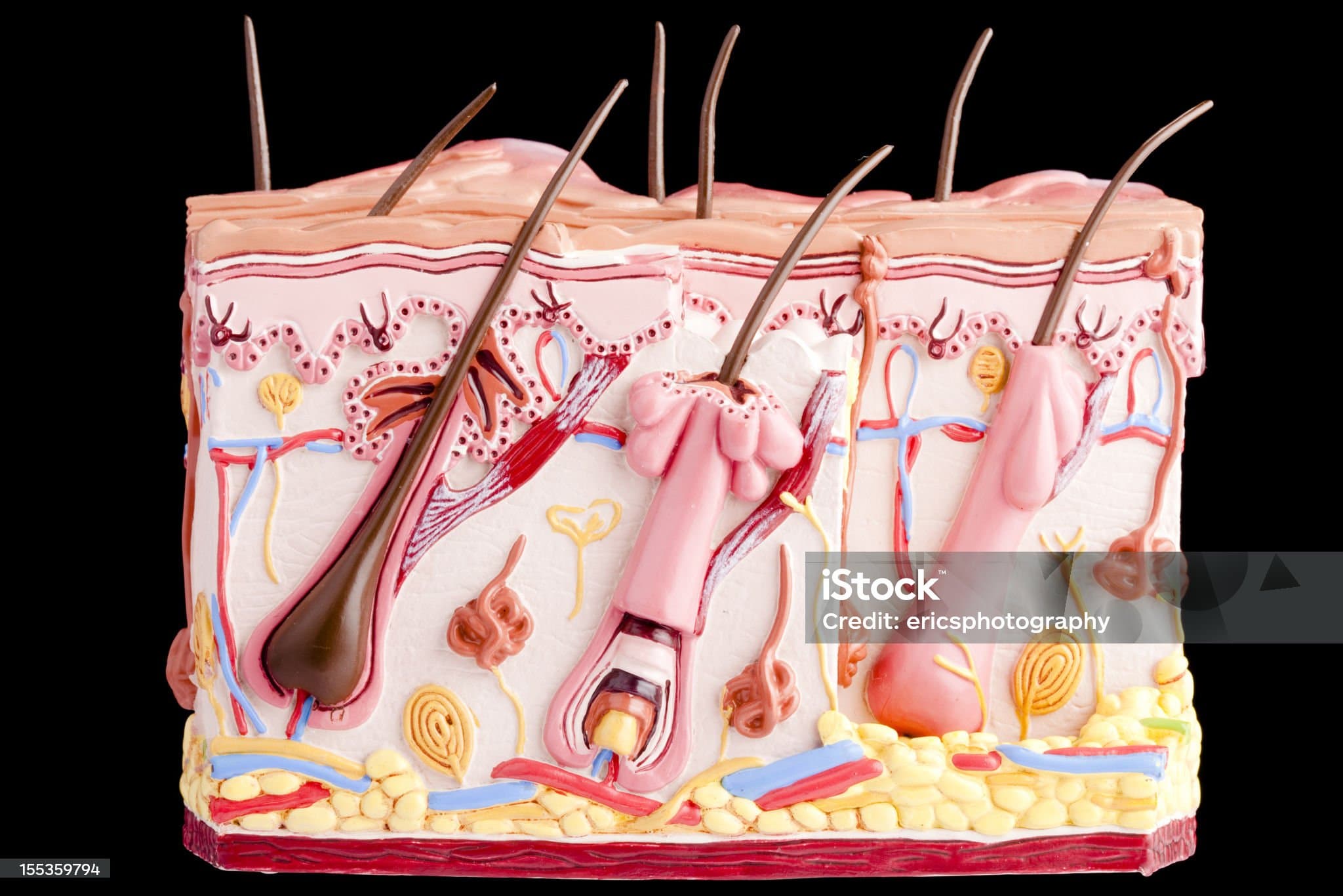 지루성 두피염 이해를 위한 피지선의 생리학과 병리학