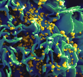 섬유근육통 초기증상 원인 치료법