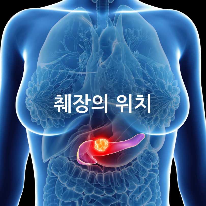 췌장암 초기증상