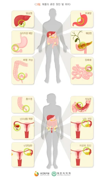 배를 콕콕 찌르는 통증의 8가지 원인 하는법 알아보기로 정리_8