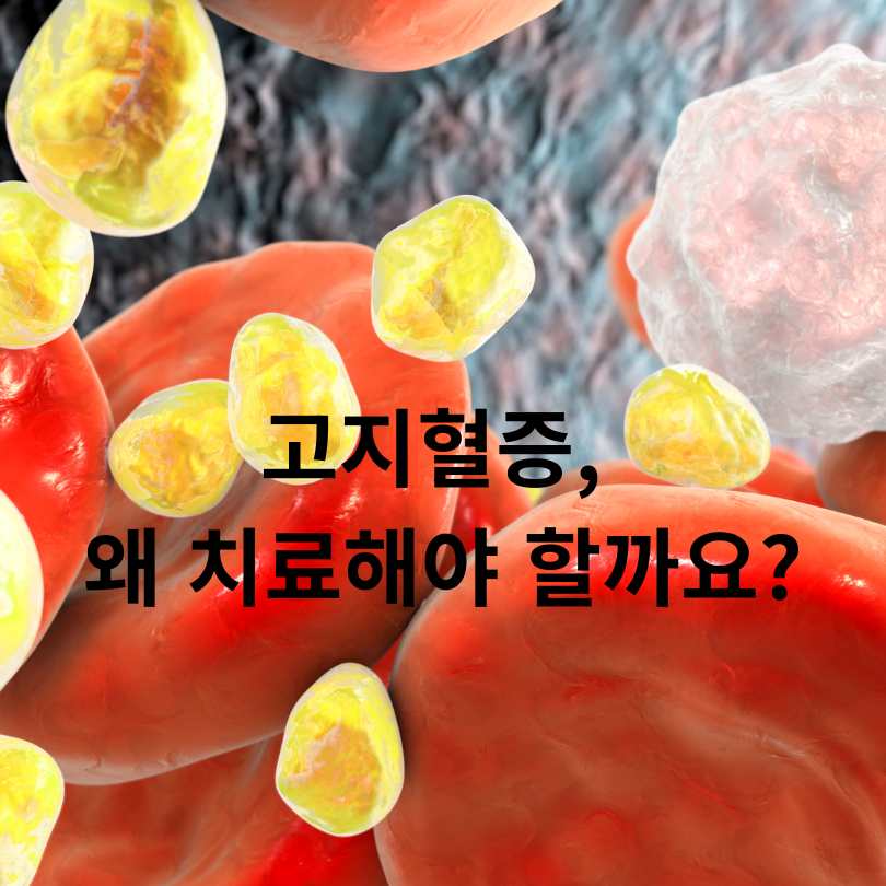 고지혈증 약을 중단하면 위험한 이유