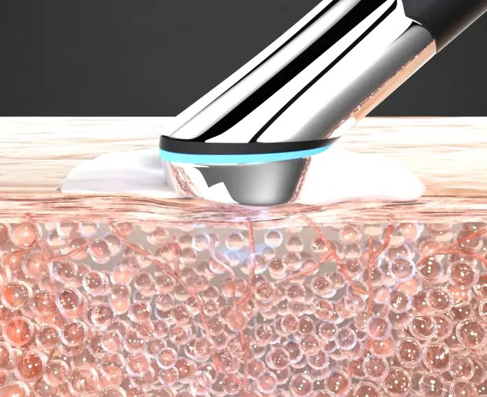 에이지알 부스터 힐러 원리