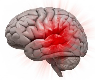 뇌손상과의 관계