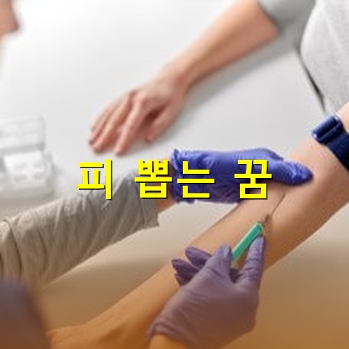 건겅검진에서-팔뚝을-동여매고-채혈하는-모습