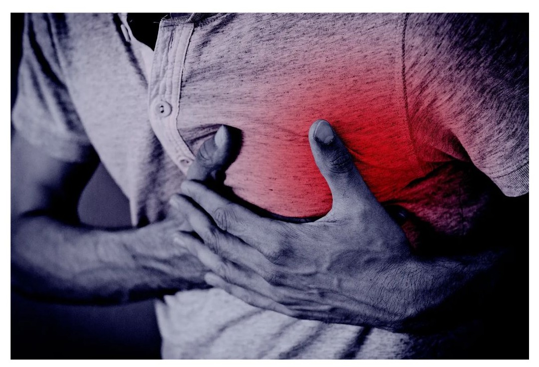 대동맥 박리 증상 가슴 통증 이미지