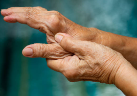 류마티스 관절염