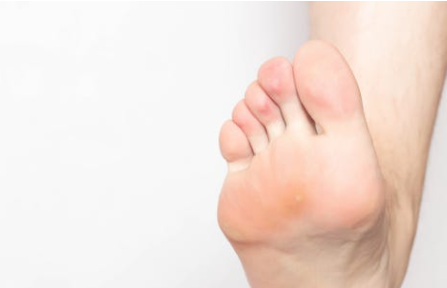 발바닥 통증을 악화시키는 습관