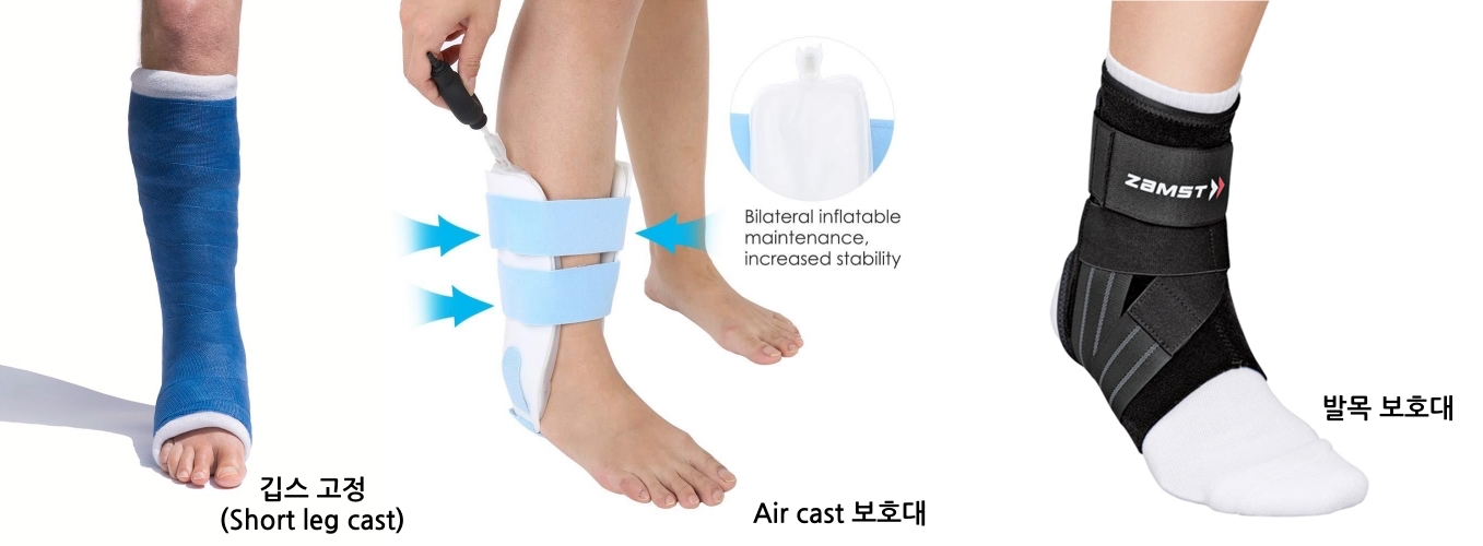 shortlegcast-aircast-anklebrace