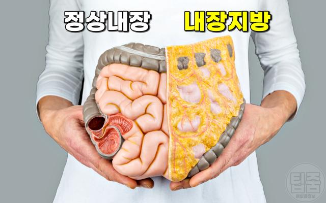 복부 내장지방 확인,뱃살, 팁줌