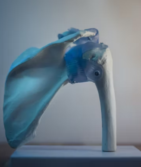 골다공증에 좋은 음식 10가지