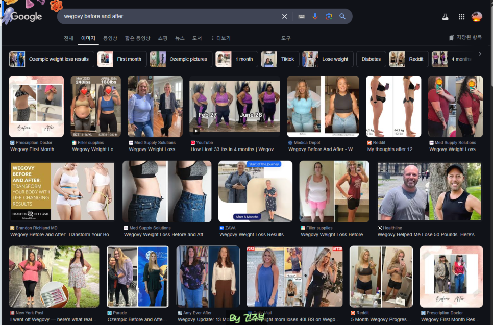 구글에서 위고비 before and after 사진

(글 그림 : 건주부, 그림 출처 : Google)