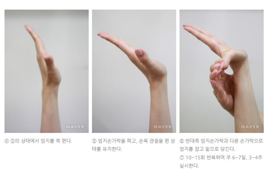 손목터널증후군 증상 원인 치료 방법