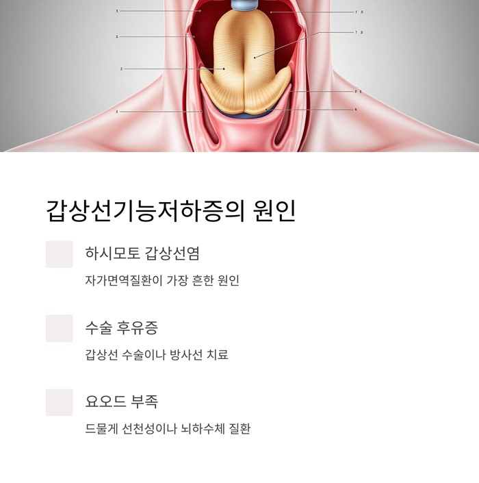 갑상선기능저하증 증상 7가지, 조기발견이 중요 요약 이미지